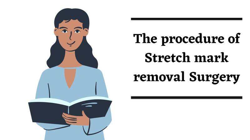 Stretch Mark Removal Surgery
