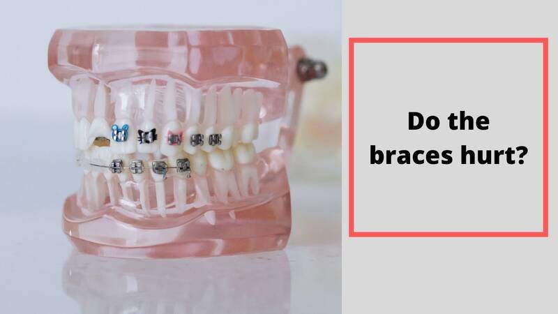 How Do Braces Move Teeth