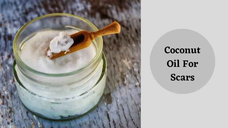 coconut oil for scars