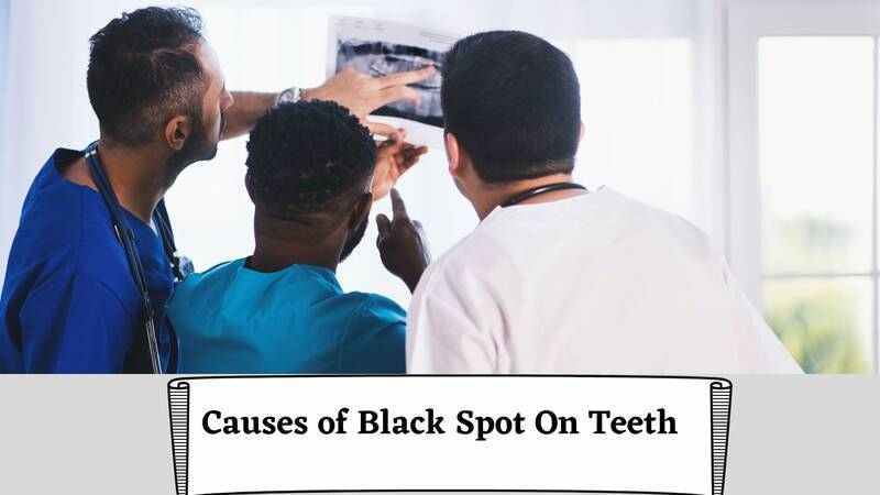 causes of black spots on tooth
