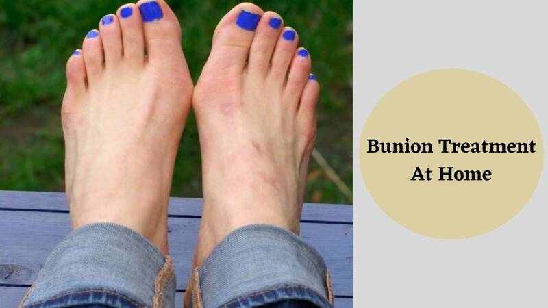 Bunion Treatment At Home